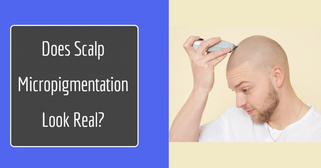 scalp micropigmentation