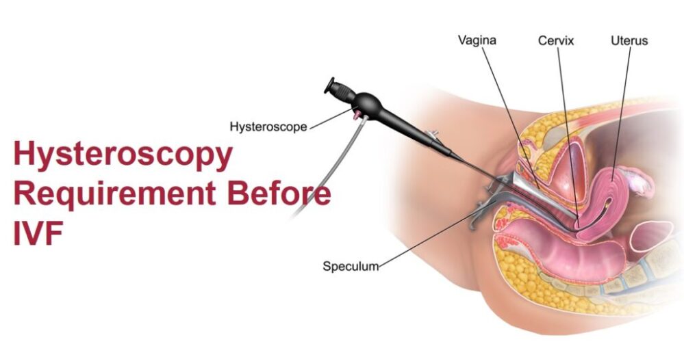 hysteroscopy know everything