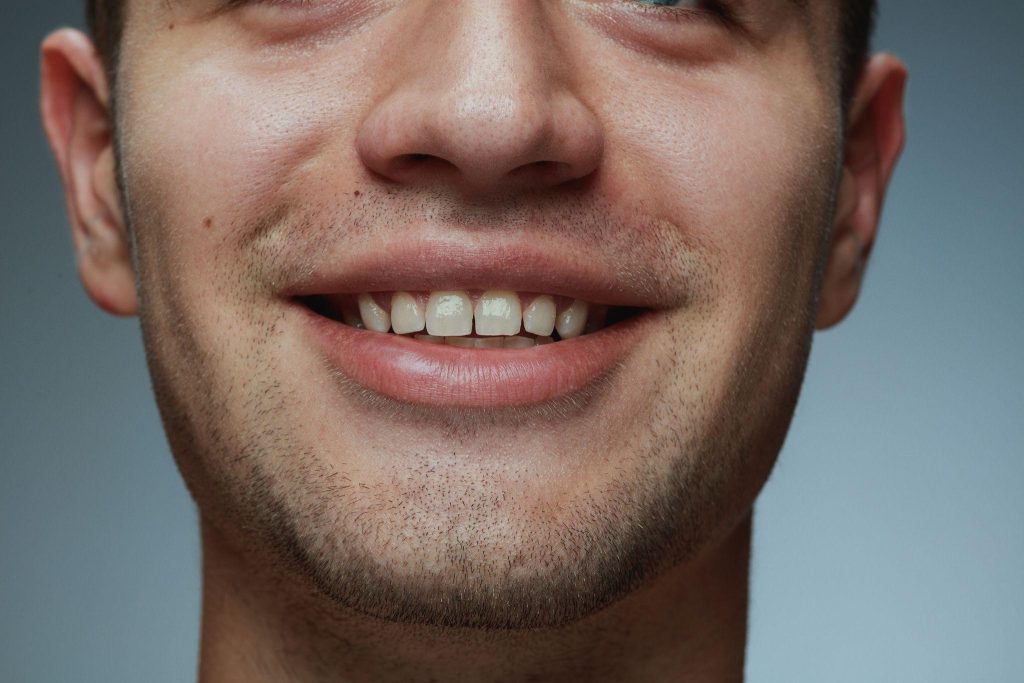 diastema