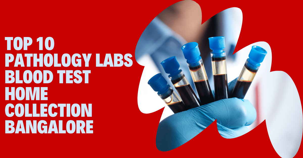 Top 10 pathology labs blood test home collection bangalore
