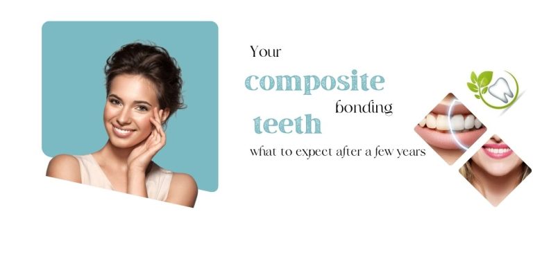 Your composite bonding teeth – what to expect after a few years