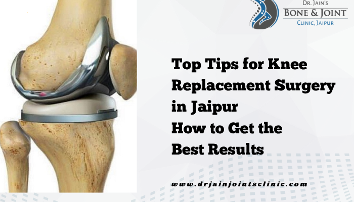 knee replacement surgery