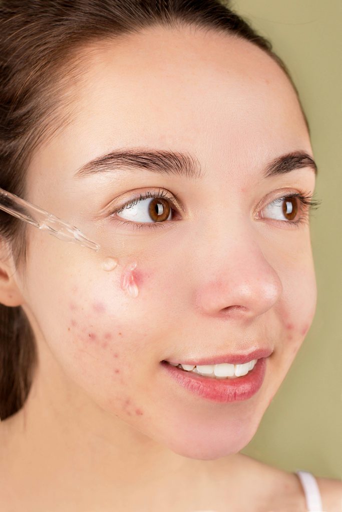 breakouts
