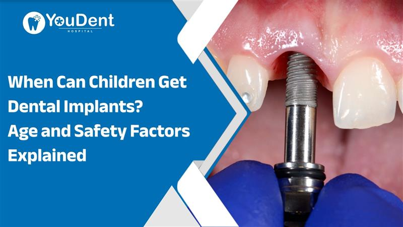 children dental implants