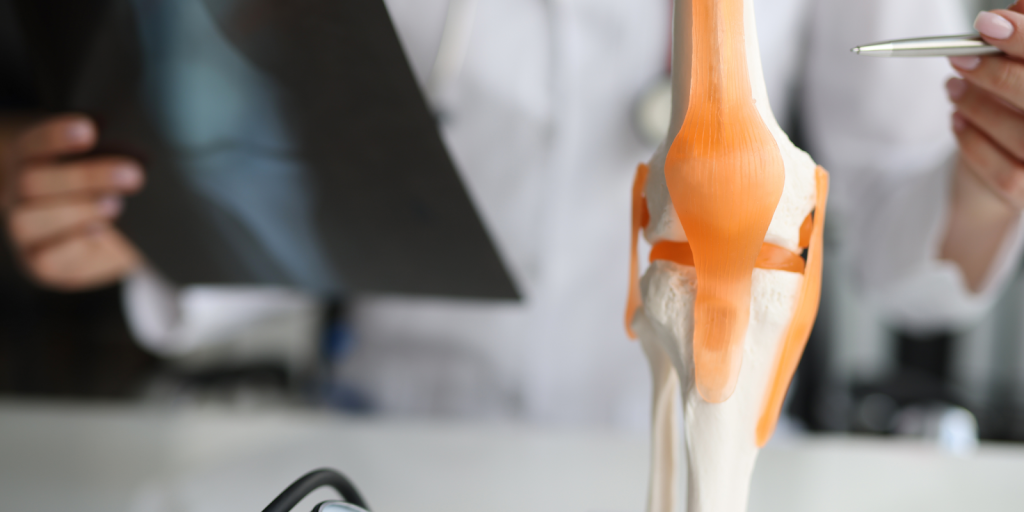 knee replacement