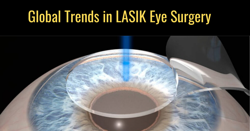 lasik eye surgery